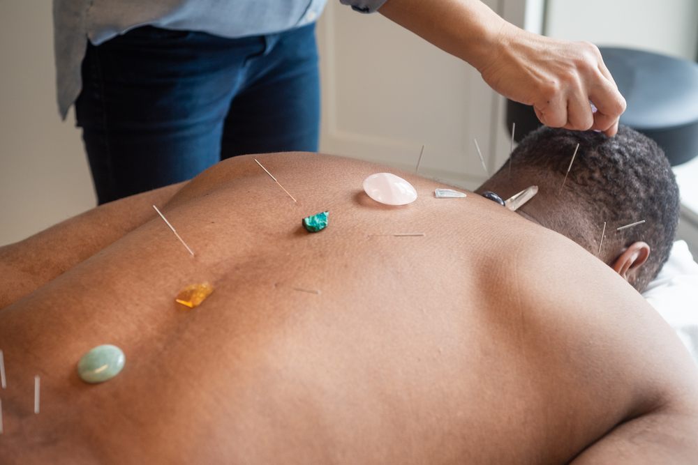 9 Best Acupuncturists in Chicago Zencare Blog